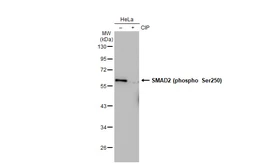 Anti-SMAD2 (phospho Ser250) antibody [GT1291] used in Western Blot (WB). GTX03203