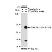 Anti-SMAD2 (phospho Ser250) antibody [GT1291] used in Western Blot (WB). GTX03203