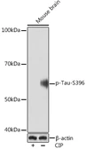 Anti-Tau (phospho Ser396) antibody [GT1292] used in Western Blot (WB). GTX03204