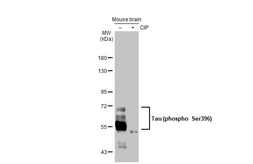 Anti-Tau (phospho Ser396) antibody [GT1292] used in Western Blot (WB). GTX03204
