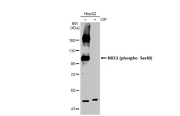 Anti-NRF2 (phospho Ser40) antibody [GT1297] used in Western Blot (WB). GTX03209