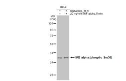 Anti-IKB alpha (phospho Ser36) antibody [GT1298] used in Western Blot (WB). GTX03210