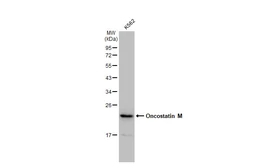Anti-Oncostatin M antibody [GT1300] used in Western Blot (WB). GTX03212