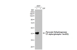 Anti-Pyruvate Dehydrogenase E1 alpha (phospho Ser293) antibody [GT1301] used in Western Blot (WB). GTX03213