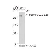 Anti-RPB1 CTD (phospho Ser2) antibody [GT1302] used in Western Blot (WB). GTX03214