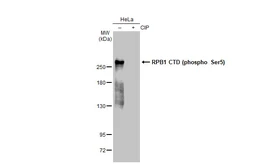 Anti-RPB1 CTD (phospho Ser5) antibody [GT1303] used in Western Blot (WB). GTX03215