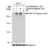 Anti-RPB1 CTD (phospho Ser5) antibody [GT1303] used in Western Blot (WB). GTX03215