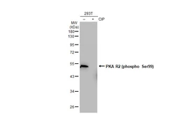 Anti-PKA R2 (phospho Ser99) antibody [GT1304] used in Western Blot (WB). GTX03216