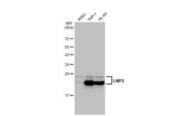 Anti-LMP2 antibody [GT1307] used in Western Blot (WB). GTX03219