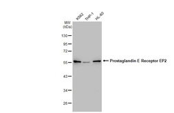 Anti-Prostaglandin E Receptor EP2 antibody [GT1308] used in Western Blot (WB). GTX03220