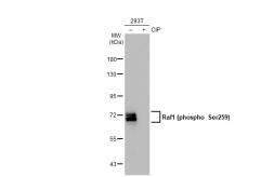 Anti-Raf1 (phospho Ser259) antibody [GT1309] used in Western Blot (WB). GTX03221