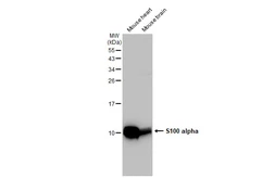 Anti-S100 alpha antibody [GT1311] used in Western Blot (WB). GTX03223