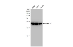 Anti-SFRS3 antibody [GT1312] used in Western Blot (WB). GTX03224