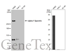 Anti-alpha 1 Spectrin antibody [GT1313] used in Western Blot (WB). GTX03225