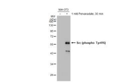 Anti-Src (phospho Tyr416) antibody [GT1314] used in Western Blot (WB). GTX03226