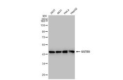 Anti-SSTR5 antibody [GT1315] used in Western Blot (WB). GTX03227