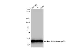 Anti-Neurokinin 1 Receptor antibody [GT1316] used in Western Blot (WB). GTX03228