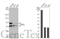 Anti-TFE3 antibody [GT1317] used in Western Blot (WB). GTX03229