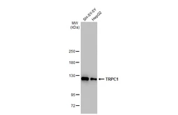 Anti-TRPC1 antibody [GT1318] used in Western Blot (WB). GTX03230