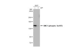 Anti-SMC1 (phospho Ser957) antibody [GT1321] used in Western Blot (WB). GTX03233