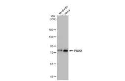 Anti-PIAS1 antibody [GT1323] used in Western Blot (WB). GTX03235