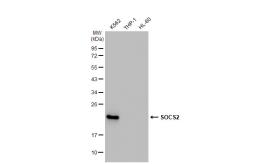 Anti-SOCS2 antibody [GT1326] used in Western Blot (WB). GTX03238