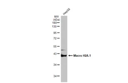 Anti-Macro H2A.1 antibody [GT1329] used in Western Blot (WB). GTX03241