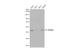 Anti-EIF4A3 antibody [GT1331] used in Western Blot (WB). GTX03243