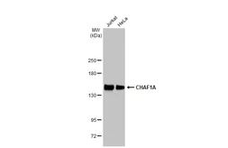 Anti-CHAF1A antibody [GT1332] used in Western Blot (WB). GTX03244