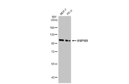 Anti-HSP105 antibody [GT1336] used in Western Blot (WB). GTX03248