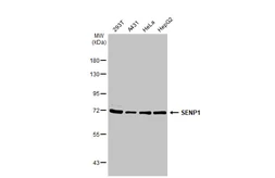 Anti-SENP1 antibody [GT1340] used in Western Blot (WB). GTX03252