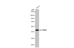 Anti-PHD1 antibody [GT1342] used in Western Blot (WB). GTX03254