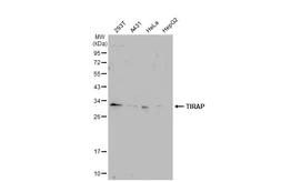 Anti-TIRAP antibody [GT1343] used in Western Blot (WB). GTX03255