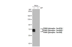Anti-PAK4 (phospho Ser474) / PAK5 (phospho Ser602) / PAK6 (phospho Ser560) antibody [GT1344] used in Western Blot (WB). GTX03256