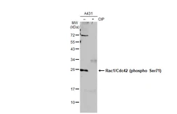 Anti-Rac1 + CDC42 (phospho Ser71) antibody [GT1345] used in Western Blot (WB). GTX03257