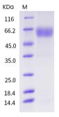 Human CD28 (ECD) protein, human IgG1 Fc tag. GTX03266-pro