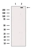 Anti-Filaggrin antibody used in Western Blot (WB). GTX03270