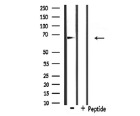 Anti-Involucrin antibody used in Western Blot (WB). GTX03271