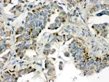 Anti-BMP5 antibody used in IHC (Paraffin sections) (IHC-P). GTX03273