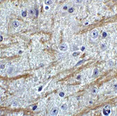 Anti-PRDM16 antibody used in IHC (Paraffin sections) (IHC-P). GTX03275