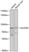 Anti-SLCO2B1 antibody used in Western Blot (WB). GTX03278