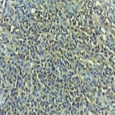 Anti-Caspase 3 (cleaved Asp175) antibody used in IHC (Paraffin sections) (IHC-P). GTX03281