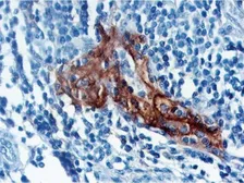 Anti-PD-L1 antibody [405-9A11] used in IHC (Paraffin sections) (IHC-P). GTX03297