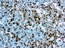 Anti-ALK antibody [4A4] used in IHC (Paraffin sections) (IHC-P). GTX03298