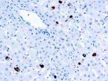 Anti-Hepatitis B virus Surface Antigen antibody [5C3] used in IHC (Paraffin sections) (IHC-P). GTX03300