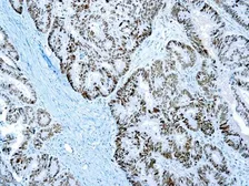 Anti-PMS2 antibody [A16-4] used in IHC (Paraffin sections) (IHC-P). GTX03301