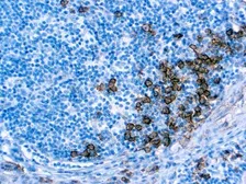 Anti-Syndecan-1 / CD138 antibody [EP201] used in IHC (Paraffin sections) (IHC-P). GTX03310