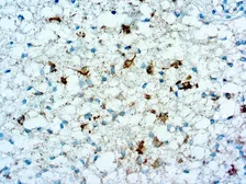 Anti-IDH1 (R132H Mutant) antibody [R132H] used in IHC (Paraffin sections) (IHC-P). GTX03323
