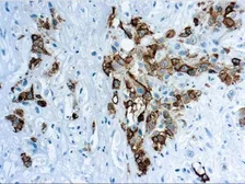 Anti-Mesothelin antibody [YP158] used in IHC (Paraffin sections) (IHC-P). GTX03327