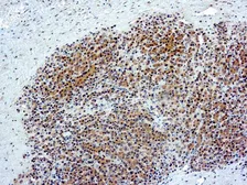 Anti-Glypican-3 antibody [YP7] used in IHC (Paraffin sections) (IHC-P). GTX03328